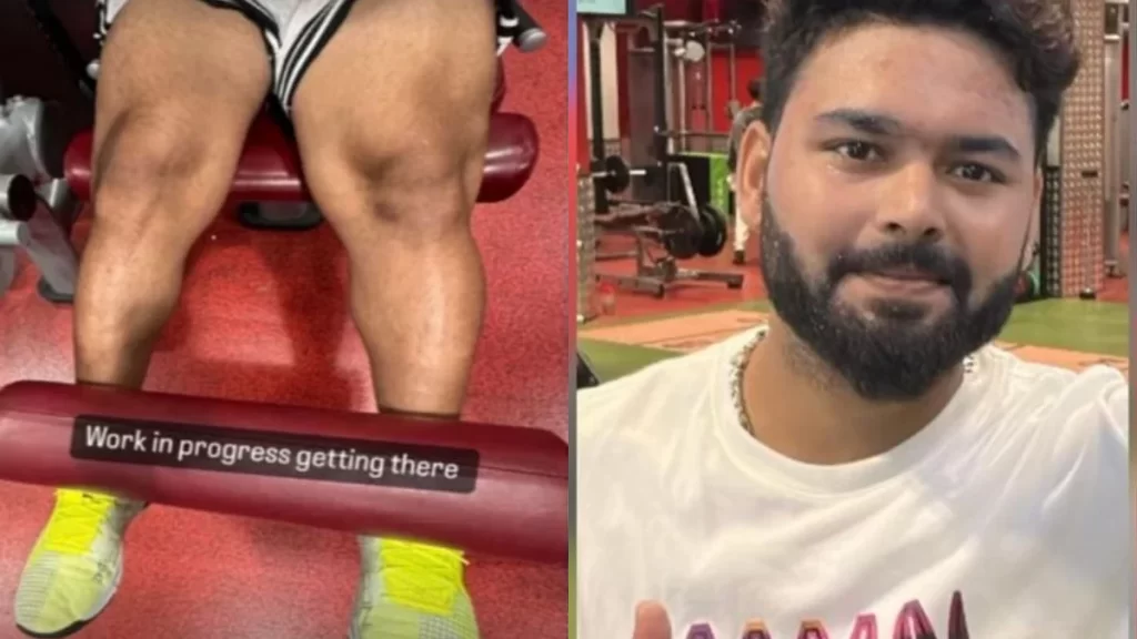 Rishabh Pant Shares Brutal Scar From His Accident
